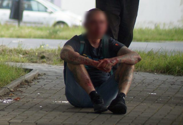 Pobity, zakrwawiony mężczyzna siedział na chodniku. Jak twierdził, doszło do „małego nieporozumienia”