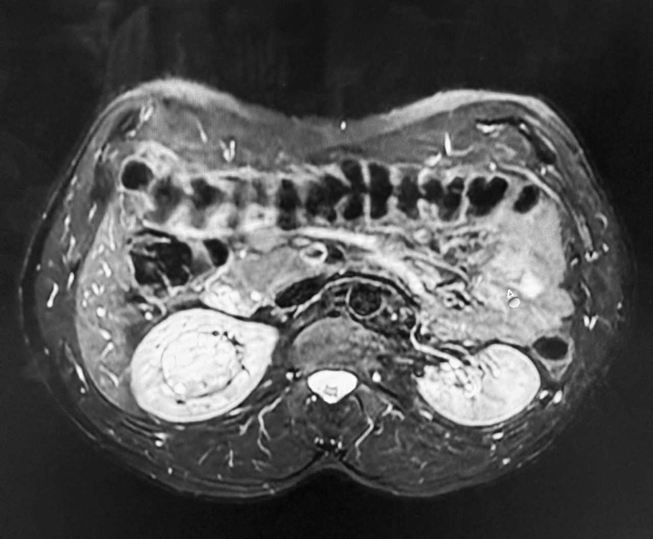 Urologia 6